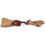 Simulaids 800-642 Xtreme Trauma Moulage Arm