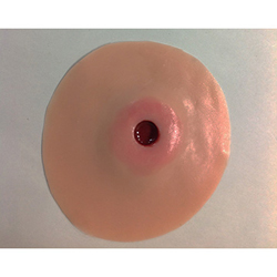 Simulaids 800-652 Stoma Adult