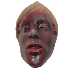 Simulaids 800-6732B Burn Of The Face African-American (Manikin Use O