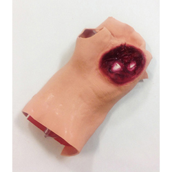 Simulaids 800-6881 Gunshot Wound Palm